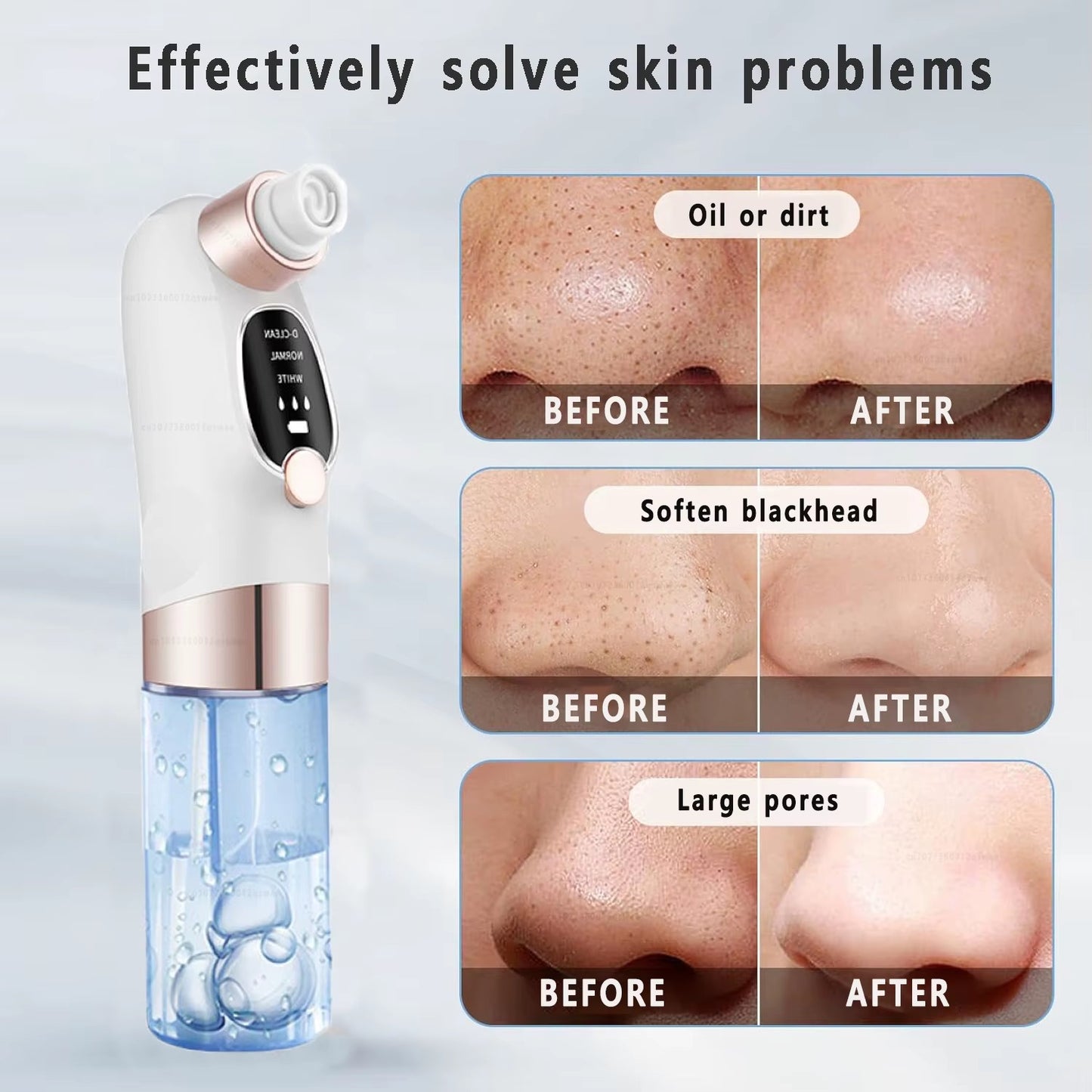 Blackhead Remover with Water Cartridge
